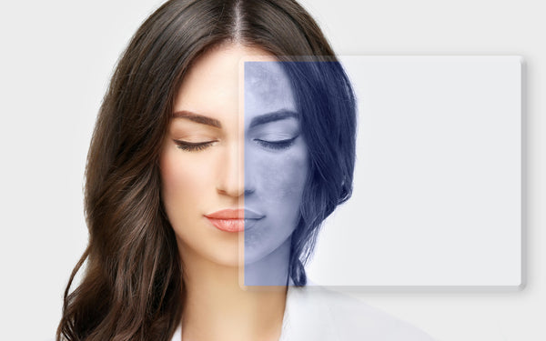 <strong> ¿Cómo eliminar manchas pigmentadas en la piel?</strong>